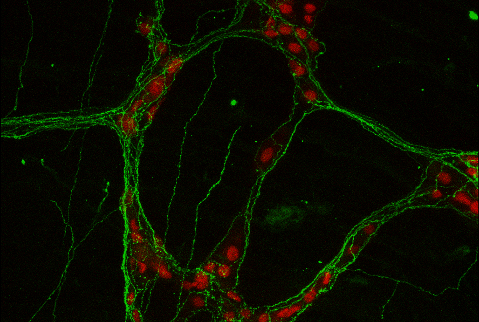 cells stained red and green