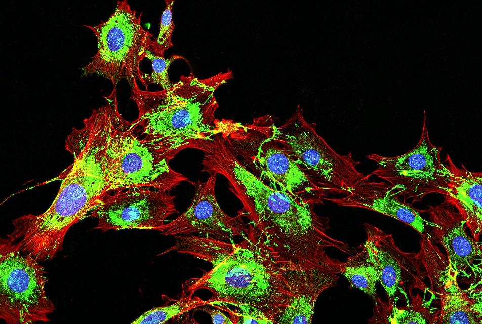 metastatic cancer cells