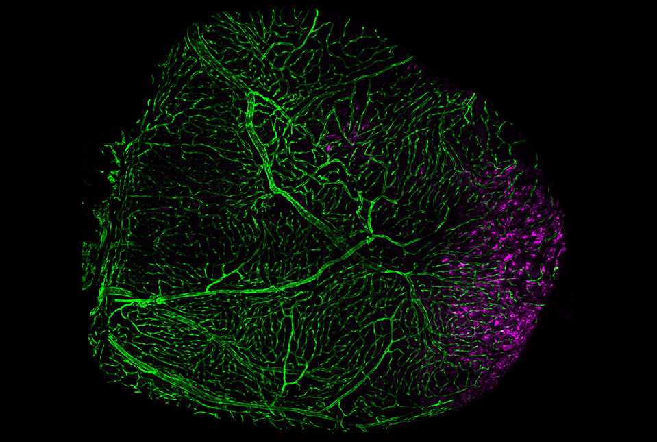 zebrafish heart