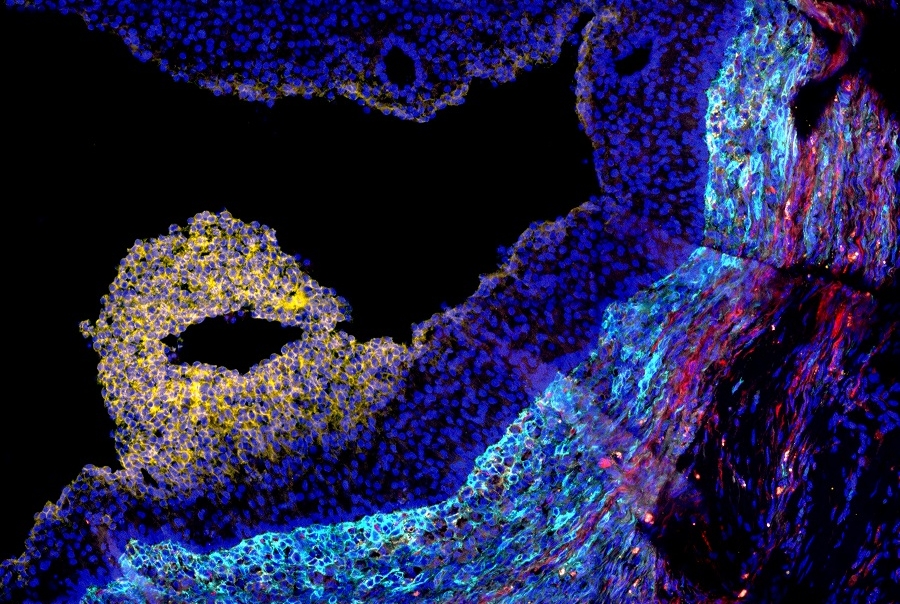 microscopic image of ovarian follicle