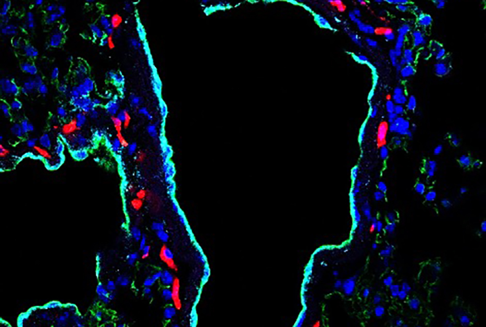 Image of a mouse lung with staining to show blood vessels and dextran