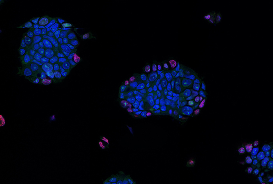 clumps of cells stained blue and pink