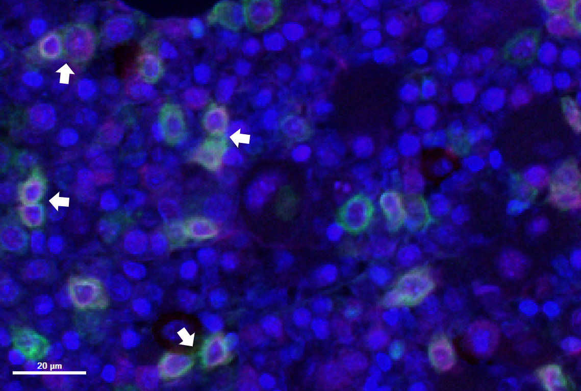 cells stained blue, green and magenta