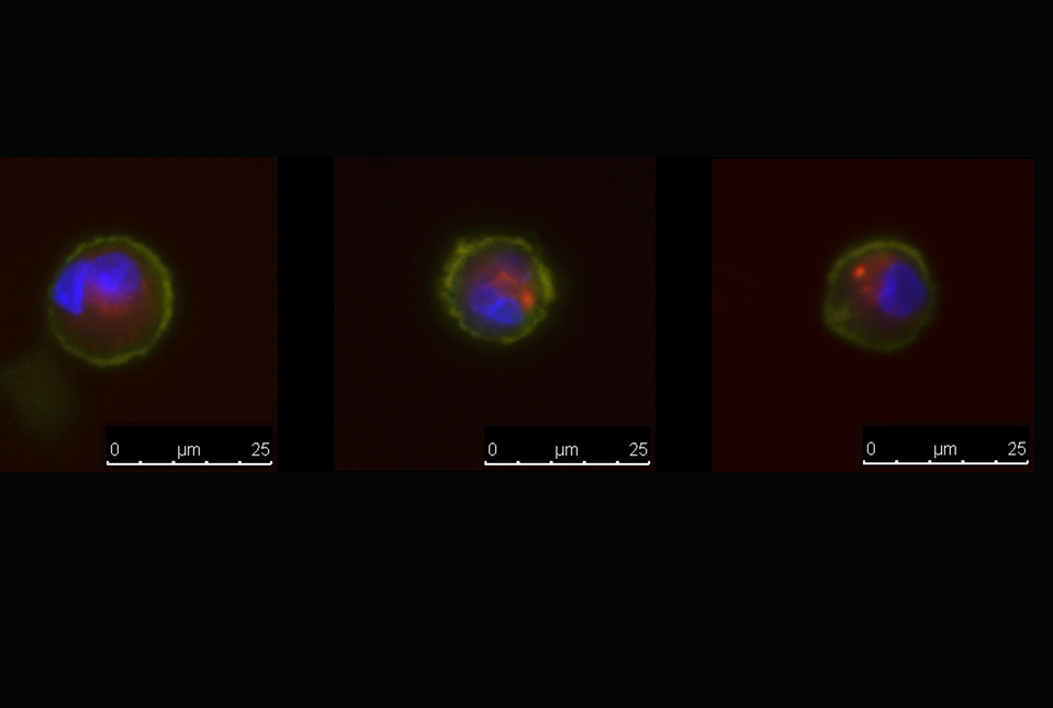 immunofluorescent image of dual-positive cells