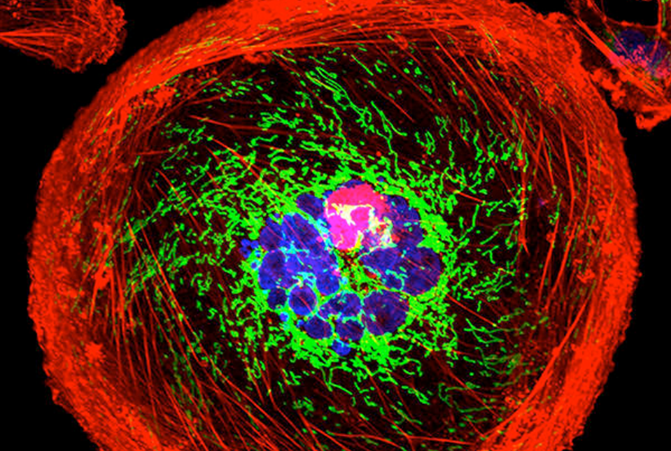 Triple-negative breast cancer cell