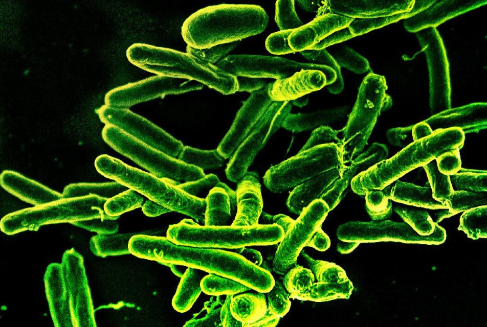 tuberculosis bacteria 