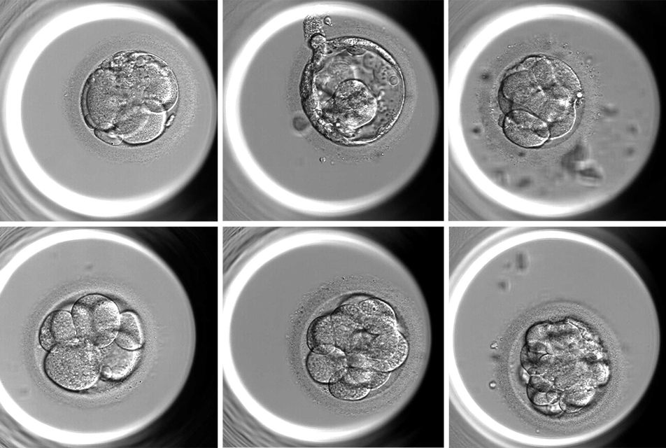 microscope images of blastocyst stage embryos