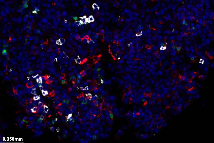 Immunofluorescent image of immune cells labeled in red, white and green