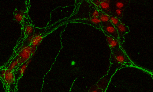 cells stained red and green