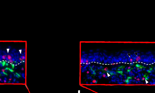 resident memory T cells
