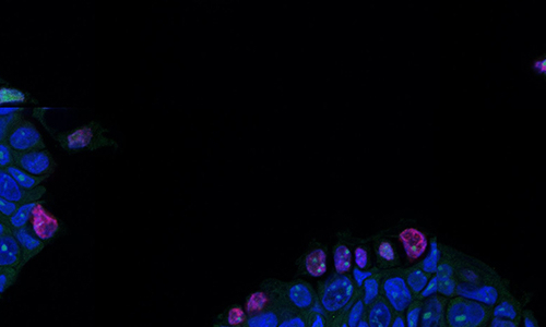 clumps of cells stained blue and pink