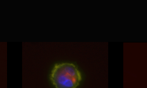 immunofluorescent image of dual-positive cells