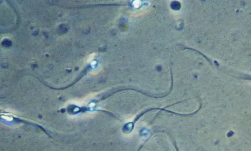 sperm cells swimming