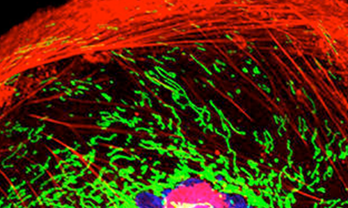 Triple-negative breast cancer cell