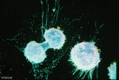 blue spherical objects against a black backdrop