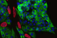 mouse beta cells in pancreas