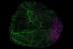 zebrafish heart