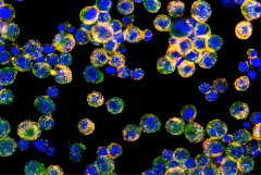 T cells able to pick up lipds