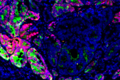 colorectal cancer cells