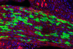 stem cells tendon and ligaments