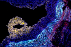 microscopic image of ovarian follicle