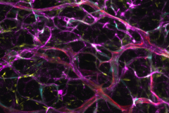 blood vessels from endothelial cells