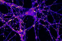 Neurons stained for lipid droplets
