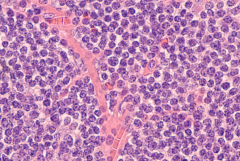 H&amp;E staining of blood cells