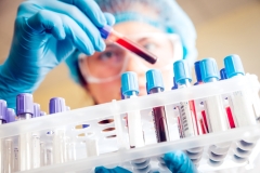 researcher holding a vial of blood over a rack of vials