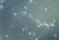 sperm cells swimming
