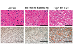 histology of liver tissue