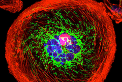 Triple-negative breast cancer cell