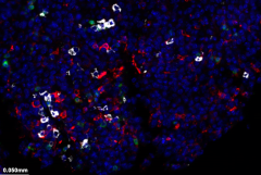 Immunofluorescent image of immune cells labeled in red, white and green